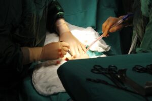 Laparoscopic vs. Open Surgery: Which is Better for You?